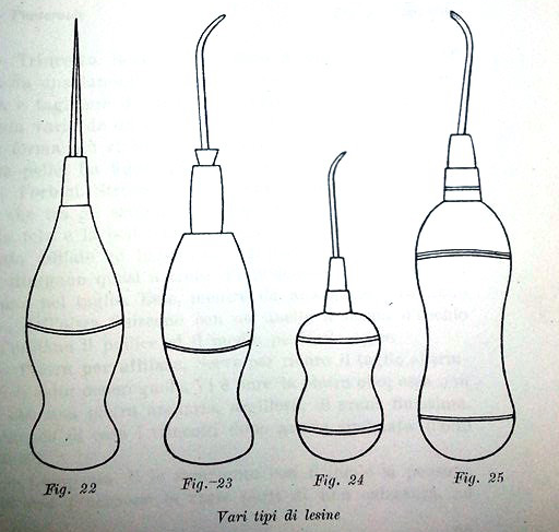 Illustrazione dei diversi tipi di lesina